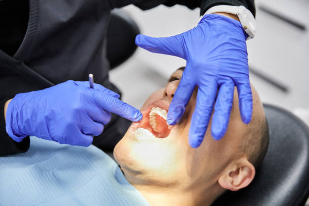 Best Emergency Dental Care for Broken or Chipped Teeth in Absecon Highlands, NJ